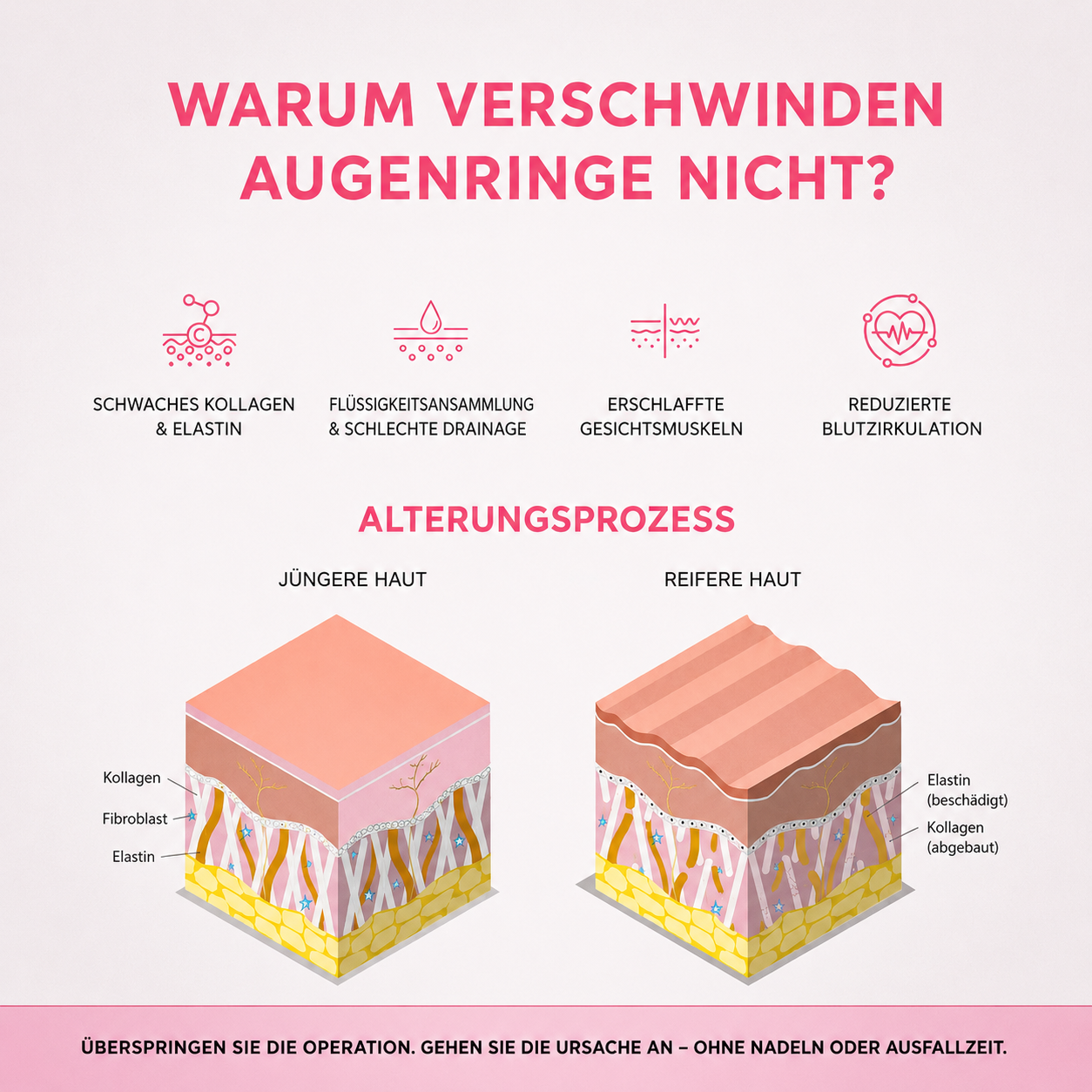 Ursachen von Augenringen