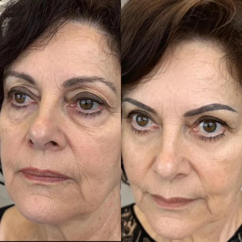 Vorher-Nachher-Vergleich